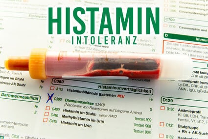 Histaminintoleranz